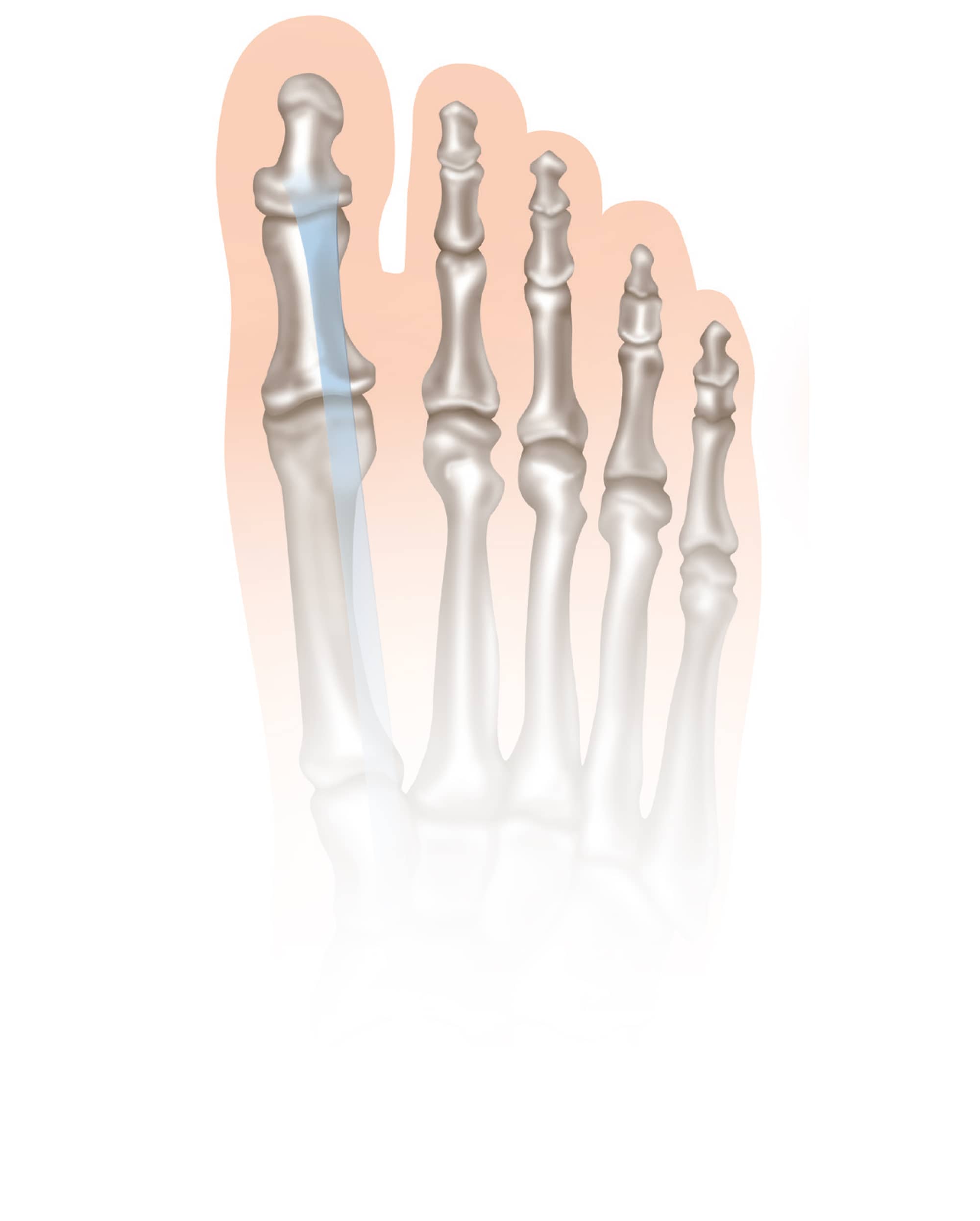 Illustration anatomique d'un pied sain